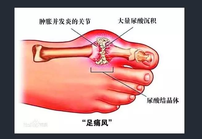 一怒之下怒了一下是什么梗?